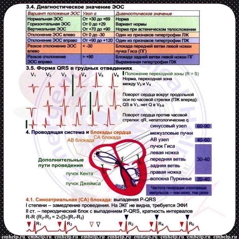 Шпаргалки скорой помощи. Шпаргалка по расшифровке ЭКГ. Супер шпаргалка по ЭКГ. Шпора по ЭКГ. ЭКГ шпаргалка для скорой помощи.