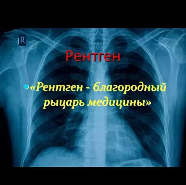 Ленинградский рентген РЕНТГЕН НА ДОМУ, УЗИ, ЭКГ, хирург + перевязки на дому, постановка мочевых катетеров; - в городе С.Петербург и Ленинградская области при переломе шейки бедра и пневмонии Рентген на дому СПб: по вашему адресу приезжает врач-рентгенолог, травматолог-ортопед с мобильным рентгеновским аппаратом, проводит диагностику травмы или заболевания, делает необходимые рентгенограммы, проявляет их на месте, дает рекомендации по дальнейшему лечению. 
УЗИ, ЭКГ, хирург + перевязки на дому, постановка мочевых катетеров 
1. Для борьбы с морщинами время от времени смазывайте лицо медом. 
2. Полезно перед сном наносить касторовое масло для ресниц. 
3. При выпадении волос втирайте в кожу головы настой лопуха. 
4. Остатками выжатого лимона смазывайте руки и локти. 
5. При шершавости кожи рук втирать в шершавые места крахмал. 
6. В качестве пудры можно использовать небольшое количество крахмала. 
7. Для подсушивания жирных волос каждый день или через день втирайте в кожу головы заварку черного чая. 
8. Полезно делать пилинг тела из кофейной гущи, необходимое количество которой можно собрать за несколько дней. 
9. Свежевыжатый сок облепихи рекомендуется в качестве маски для сухой кожи (1-1,5 столовой ложки). 
10. Настой цветков бузины отбеливает, смягчает и тонизирует сухую кожу. 
11. Для увлажнения сухой и чувствительной кожи на ночь нанести на лицо масло жожоба, смешанное с небольшим количеством воды. 
12. Для улучшения цвета лица делать маски из смеси меда и соли, которые также оказывают омолаживающее действие. 
13. Эфирное масла лаванды и чайного дерева являются естественными антисептиками, которые помогают бороться с прыщами. 
14. Утром и вечером протирать лицо чаем, заваренным в минеральной воде с кусочком сахара. Подходит для любой кожи. 
15. Регулярное питье мятного чая придает коже лица свежесть и розоватый оттенок. 
16. Полезно смазывать брови и ресницы касторовым маслом. 
17. Для глубокой чистки кожи лица использовать взбитый яичный желток и лимонный сок. Наносить на лицо слоями. 
18. Для смягчения рук втирайте в них смесь из равных частей уксуса и растительного масла. 
19. Перед сном смазывать лицо и руки смесью из равных частей оливкового масла и лимонного сока. 
20. Для очищения кожи лица применяйте смесь сухой овсянки с водой и простым йогуртом. 
21. При прыщах хорошо помогает маска из тертого яблока и небольшого количества меда. 
22. При беременности смазывать живот маслом какао во избежание появления растяжек. 
23. Для укрепления волос втирают разварившуюся гречку. 
24. Для тонких волос делают маску из взбитого одного желтка и столовой ложки растительного масла. 
25. При выпадении волос за час до мытья втирайте в кожу головы смесь из равного количества касторового масла и рома. 
26. Для укрепления волос после каждого мытья в кожу головы втирают настой крапивы (1 ст. ложка сухой крапивы на 200 г кипятка.) 
27. Чтобы волосы были сильными и шелковистыми, их моют отваром из корней аира, лопуха и листьев крапивы (всё в равных количествах).
#рентген_в_спб, #рентген_в_петербурге, #рентген_легких, #перелом_шейки_бедра, #шейка_бедра, #сделать_рентген, #сделать_рентген_на_дому, #вызвать_врача, #вызвать_врача_на_дом, #врач_на_дом, #вызвать_травматолога, #травматолог_на_дом, #перелом_ребер, #вправить_вывих, #травматолог, #перелом, #травма #вывих, #флюорография, #флюорография_на_дому, #ушиб, #пневмония 
#рентген_на_дому_спб #рентген_на_дому_Спб 
#рентген_на_дому_шейки_бедра_спб 
#рентген_на_дому_лёгкие_спб 
#рентген_на_дому_позвоночника_спб 
#рентген_на_дому_отзывы_спб 
#сделать_рентген_на_дому_спб 
#вызвать_рентген_на_дом_спб 
#УЗИ_на_дому_СПб 
#ЭКГ_на_дому_СПб 
#хирург_на_дом_спб